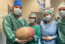 W Polsce kobiecie usunięto gigantycznego guza jajnika